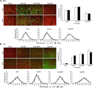 Metabolic dysregulation and decreased capillarization in skeletal muscles of male adolescent offspring rats exposed to gestational intermittent hypoxia